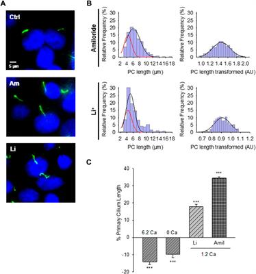 Polycystin-2 (TRPP2) regulates primary cilium length in LLC-PK1 renal epithelial cells